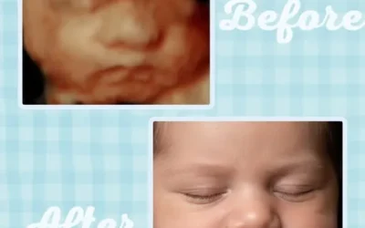Ultrasound Near Me in Fayetteville, NC: Why Little Miracles 4D Is Your Closest Private Option