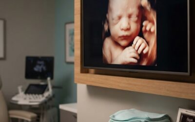 What to Expect at Your First Visit to Little Miracles 4D: Your Complete 3D Ultrasound Appointment Guide